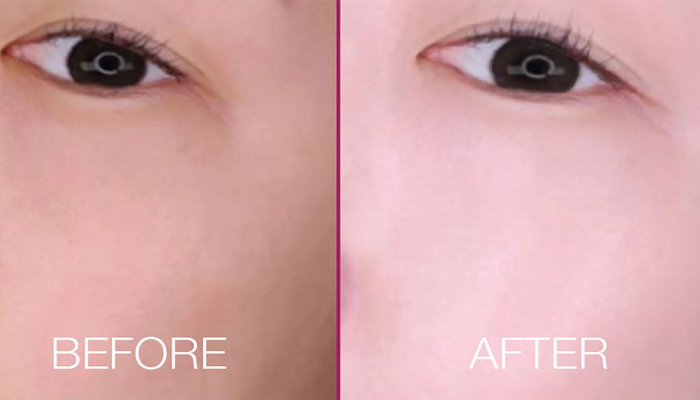 white-bb-cream,-rahasia-kulit-flawless-dalam-satu-langkah