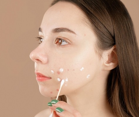 6-ciri-skincare-tidak-cocok-yang-perlu-kamu-waspadai