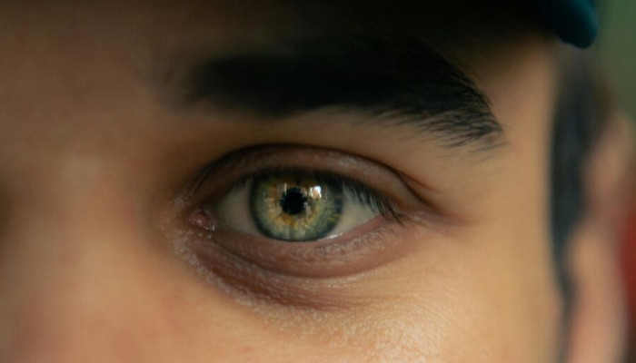 7-fakta-tentang-“mata-kedutan” 