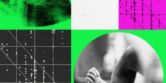 Perusahaan Bayi Desainer Sedang Bergejolak