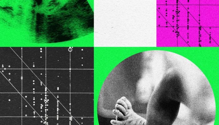 perusahaan-bayi-desainer-sedang-bergejolak