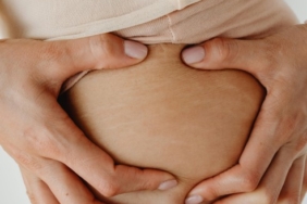 6-tips-merawat-kulit-stretch-mark-di-paha