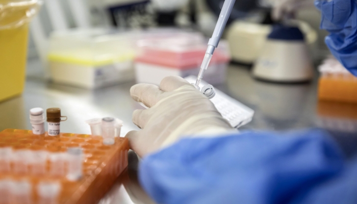 meningkatkan-sel-kekebalan-tubuh-dapat-membantu-mengendalikan-hiv-dalam-jangka-panjang