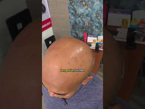 tanding batu besar batu akik giok chalcedony agate stone #batuakik