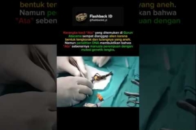 Kerangka Alien Atacama Ternyata Manusia