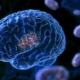 mengenal-plak-mitokondria:-temuan-baru-penyebab-alzheimer-dan-harapan-terapi-masa-depan