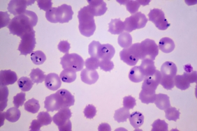 a-mutation-is-making-it-easier-for-drug-resistant-malaria-to-spread