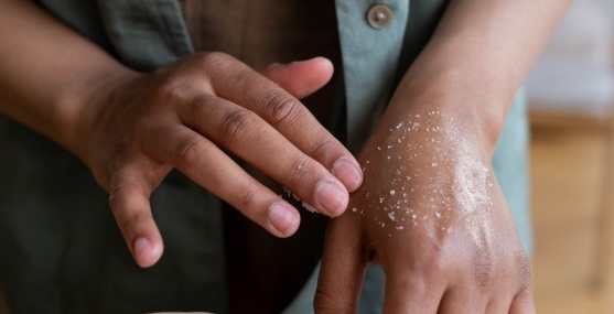 Hindari! Ini 5 Kesalahan Menggunakan Body Scrub
