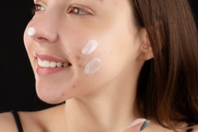 5-acne-gel-yang-bagus-untuk-kulit-berjerawat